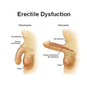 ayurveda erectile dysfunction