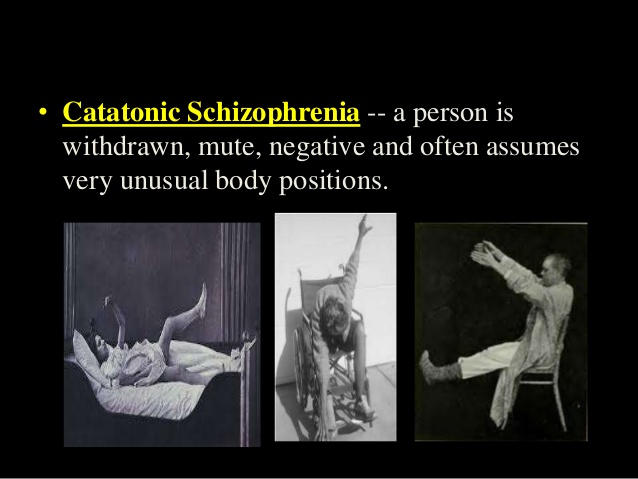 कैटेटोनिक सीजोफ्रेनिया catatonic schizophrenia  in hindi