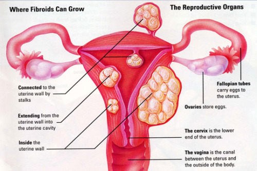 menorrhagia ayurveda